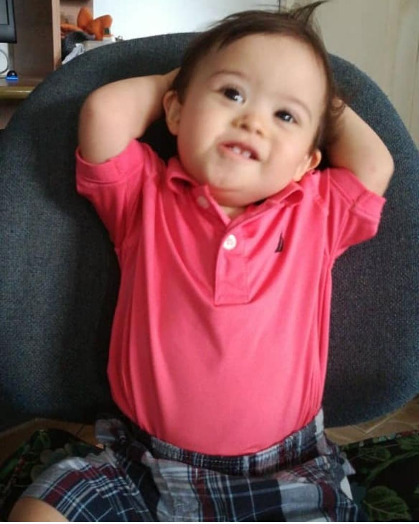 Ignacio David bebé sonriendo con síndrome de Down en Venezuela