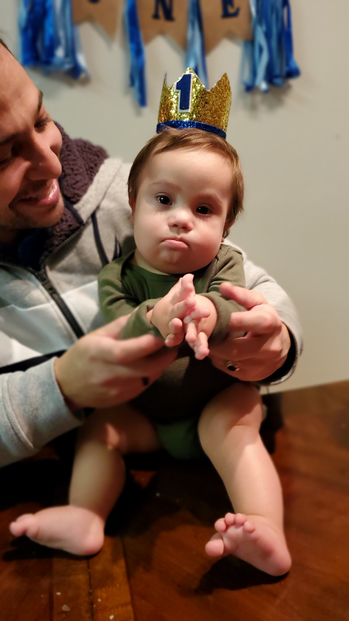 Liam, bebé con síndrome de down en su primer cumpleaños